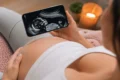 App de Ultrassom pelo Celular: Guia