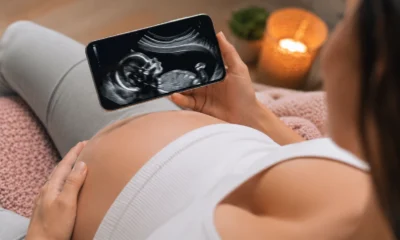 App de Ultrassom pelo Celular: Guia