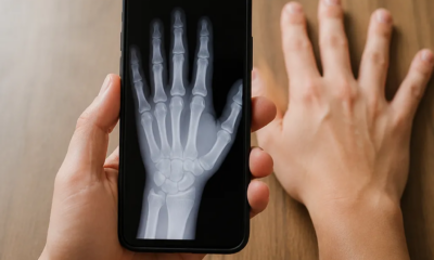 Como Fazer Raio-X no Celular: Guia Prático e Completo