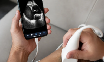 Simule Ultrassom no Celular: Guia Prático
